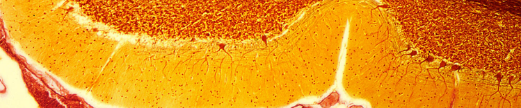 aging-brain