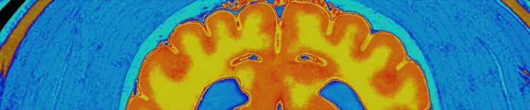 Cambiamenti del Purina Institute nell’invecchiamento del cervello