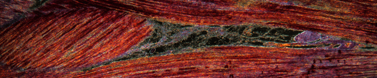 tejido muscular