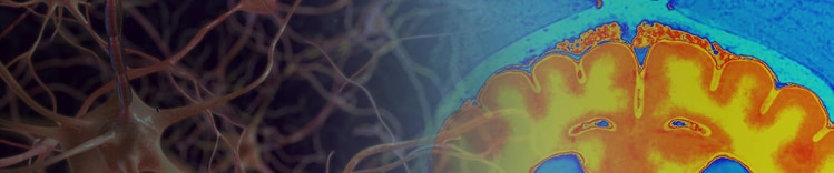 Maladies du cerveau