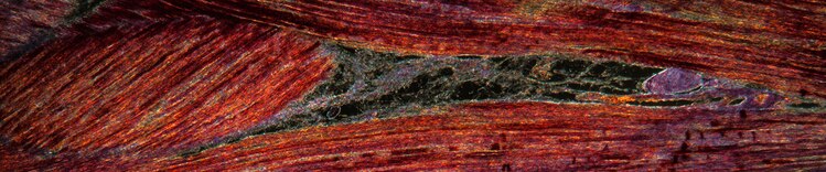 tissu musculaire