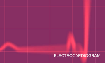 electrocardiogram