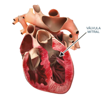 heart-diagram