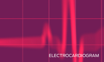 echocardiogram