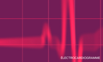 électrocardiogramme