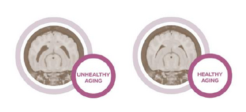 unhealthy-healthy-aging-brain